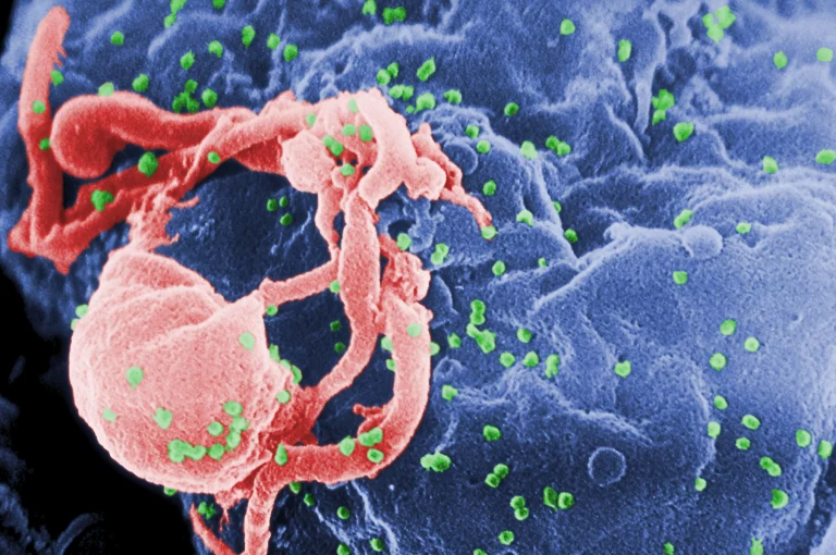 Scientists from Uganda are developing gene therapy to treat HIV