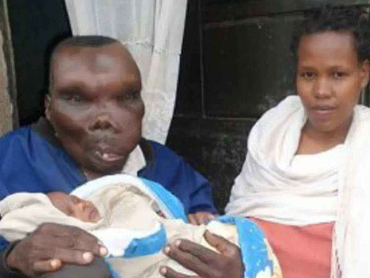 Meet the Ugliest Man in Uganda who Clinched Guinness World Record