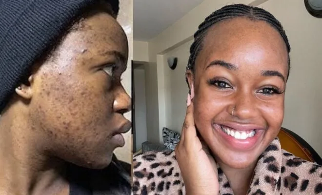 Skincare Secrets Kenyan Celebrities Live by