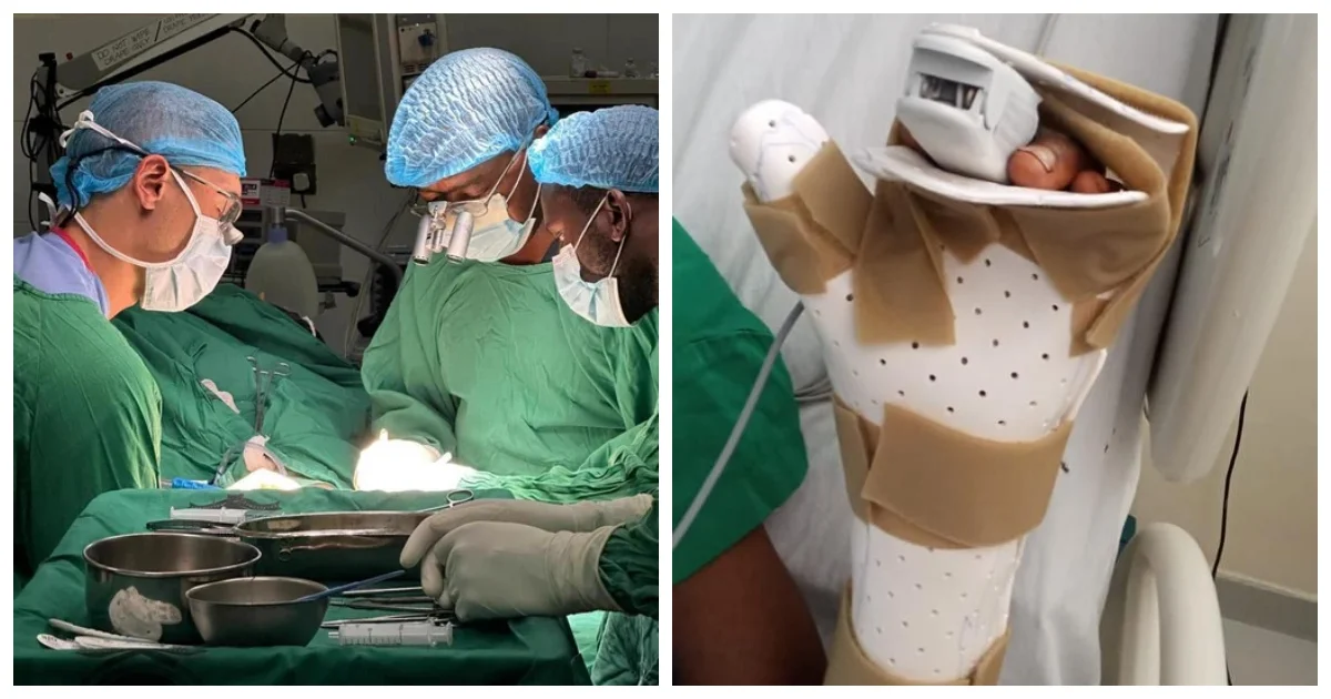 Doctors at MTRH fix amputated arm