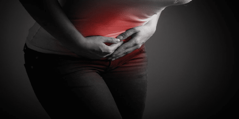 Endometriosis: Everything You Need to Know