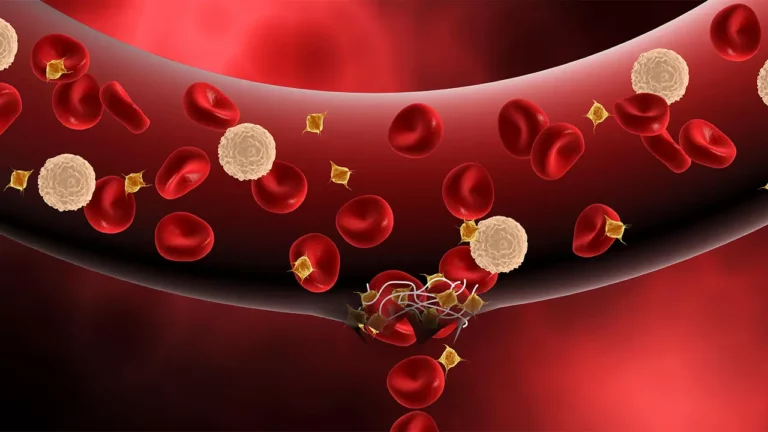 Understanding Hemophilia: Symptoms, Causes, and Care