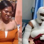  CS Kipchumba Murkomen visits gospel singer Rachel Wandeto at KNH after alleged petrol attack in Nairobi linked to her pro-Ruto tattoos left her with severe burns.